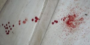 Τραγωδία σε ασανσέρ τράπεζας –Υπάλληλος έχασε τη ζωή του όταν καταπλακώθηκε από