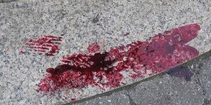 επίθεση
