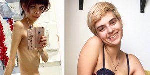 Instagram/ my_life_without_ana