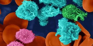 Έλληνες ερευνητές βρήκαν γενετική μετάλλαξη που ευθύνεται για ευαισθησίες του αν