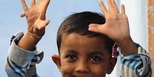 Αυτό είναι το παιδί με τα… 25 δάχτυλα [εικόνες]