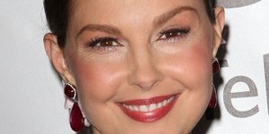 Διάσημη σταρ απέκτησε μάγουλα-τούμπανο από κακή πλαστική [εικόνες]