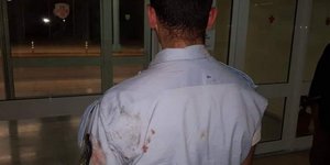 Επίθεση σε αστυνομικούς φωτογραφία ΕΛΑΣ 