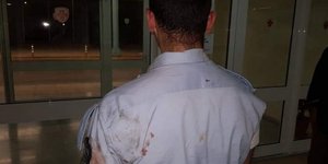 Τα τραύματα των αστυνομικών από την επίθεση των Ρομά 