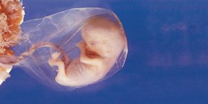 Έμβρυο από γεννετικό υλικό τριών διαφορετικών ατόμων δημιούργησαν οι επιστήμονες