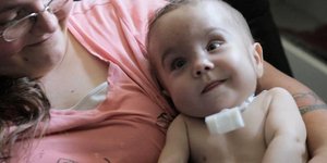 Τρισδιάστατος εκτυπωτής χαρίζει τη ζωή σε νεογέννητο μωρό [βίντεο]