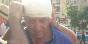 O ανταποκριτής του BBC στην Αίγυπτο που τραυματίστηκε στο κεφάλι από τους πυροβο