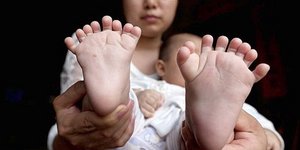  (φωτογραφίες: CEN via Daily Mail)