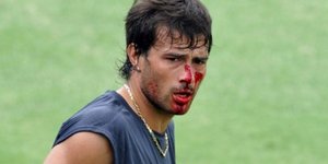 Χτύπησε τον συμπαίκτη του στην προπόνηση [βίντεο]