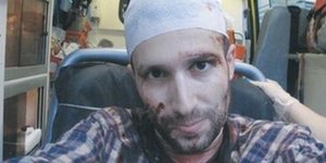 Κρανοφόροι με λοστούς επιτέθηκαν στο Κέντρο
