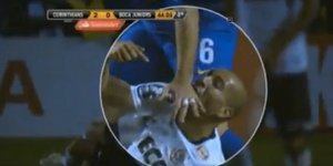 Επιθετικός δάγκωσε τον αντίπαλό του στο χέρι [βίντεο]