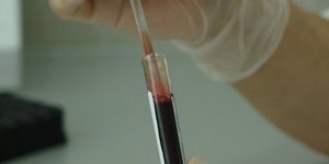 Φωτογραφία: pixabay