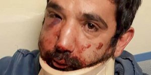 Tάσος Τοπαλίδης/ Φωτογραφία: INTIME NEWS- ΤΟΣΙΔΗΣ ΔΗΜΗΤΡΗΣ