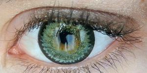 Φωτογραφίες με ένα... βλεφάρισμα: Πατέντα της Google για φακούς επαφής με κάμερα