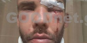 Ο 30χρονος φοιτητής μετά τον ξυλοδαρμό