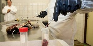 Ανήσυχος ο ΠΟΥ για την φονική γρίπη που κατασκεύασαν οι επιστήμονες