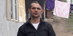 Ο άνδρας με το μισό κρανίο -Παραμορφώθηκε έπειτα από σοβαρό ατύχημα που παραλίγο