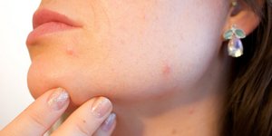 φωτογραφία: pixabay.com