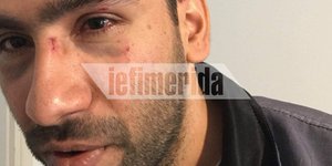 Με τραύματα και στα δύο μάτια κατέληξε το αγόρι της παρέας 