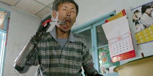 Έχασε τα χέρια του και έφτιαξε μόνος του βιονικά σε οκτώ χρόνια [εικόνες]