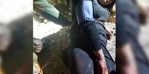 Συνοροφύλακες παρέχουν τις Α’ Βοήθειες στην τραυματισμένη γυναίκα (Φωτογραφία: US Customs & Border Protection)