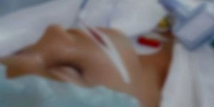 Στις ΗΠΑ για νοσηλεία μεταφέρεται η 15χρονη Μυρτώ που κακοποιήθηκε από τον Πακι