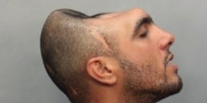 Δείτε τον άνθρωπο με το μισό κεφάλι! [βίντεο]