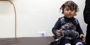 Η φρίκη του πολέμου της Συρίας σε μία φωτογραφία -Το απορημένο βλέμμα στο ματωμέ