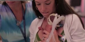 Ενας θαυματουργός χρόνος στη ζωή ενός μωρού που γεννήθηκε πολύ νωρίς -Το απίστευ