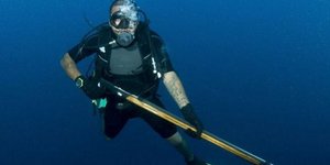 Καμάκι διαπέρασε το κρανίο του και τη... γλίτωσε! [εικόνες]