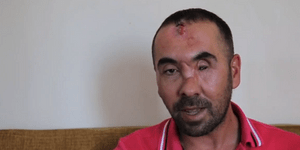 Διεθνής Αμνηστία: Οταν η Τουρκία έκανε βασανιστήρια στο δρόμο – Συγκλονιστικές μ