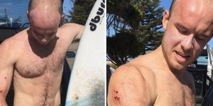 Η αστραπιαία αντίδραση του Τσάρλι Φράι