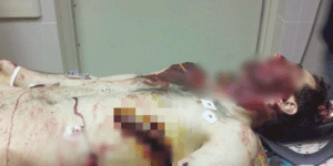 Η σοκαριστική φωτογραφία του νεκρού 26χρονου βομβιστή της Βοστώνης [εικόνα]