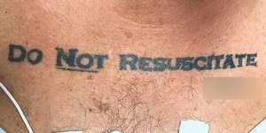 Ο ασθενής που προκάλεσε πανικό στους γιατρούς. Φωτογραφία: New England Journal of Medicine