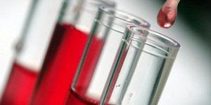 Τεστ αίματος ανιχνεύει το πότε θα πεθάνουμε