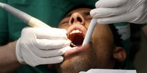 Την άφησε για μια άλλη γυναίκα και αυτή του έβγαλε ενα - ένα όλα του τα... δόντι