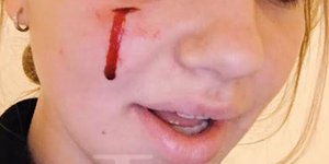 Φωτογραφία: TMZ