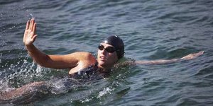 Τα δολοφονικά τσιμπήματα της μέδουσας στο κορμί της 28χρονης κολυμβήτριας [εικόν