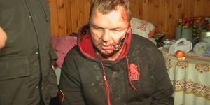 Σε κατ' οίκον περιορισμό ο Ουκρανός ακτιβιστής που έπεσε θύμα απαγωγής και άγριω