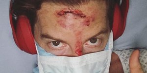 Ο Σον Γουάιτ μετά το ατύχημα (Φωτογραφία: Instagram)